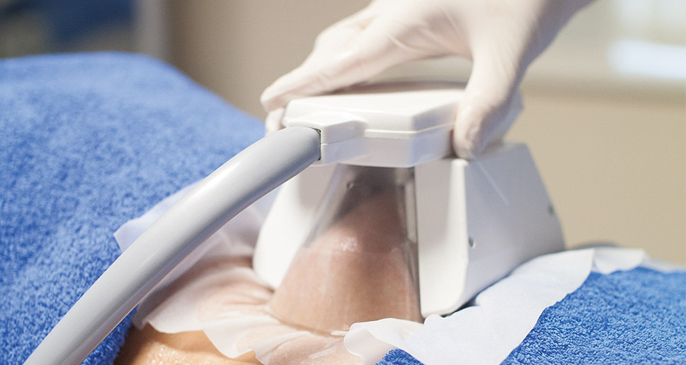 How Fat Freezing and HIFU Work Together? 2 Multiple Areas in One Session HIFU and Fat Freezing Harlow