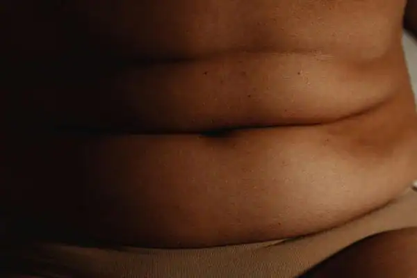 The Hidden Connection: How Stress Shapes Your Fitness and Body Composition 3 image of what stress can do on the stomach area and how Lipo 360 Harlow can help to change your body shape.